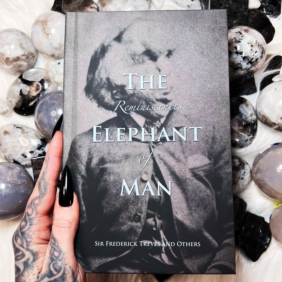 Reminiscences of the Elephant Man